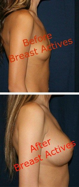 Breast actives results think Sorry, that breast actives results apologise