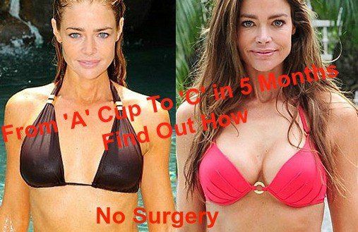 Denise-Richards-natural breast enhancement results