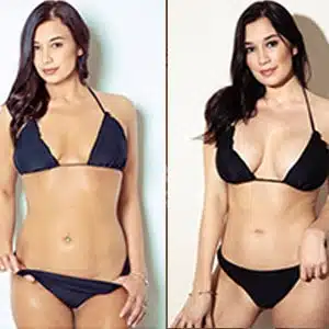 Marlene Smith before and after Breast Actives